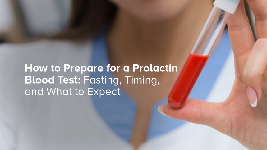How to Prepare for a Prolactin Blood Test: Fasting, Timing, and What to Expect